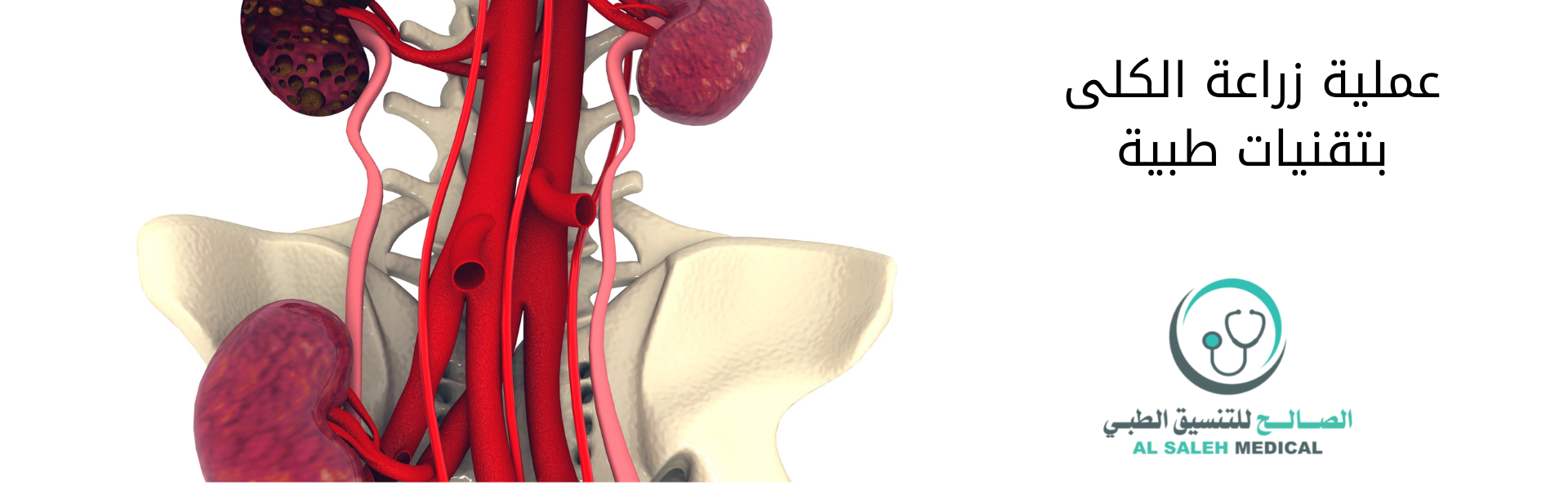 عملية زراعة الكلى في الهند| تكاليف منخفضة ورعاية متقدمة